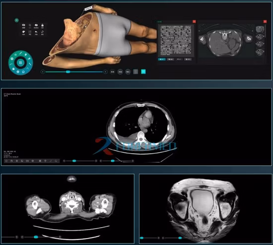 Nova fábrica de anatomia anatômica 3D médica para mesa de autópsia virtual digital escolar